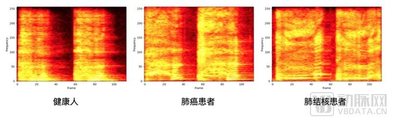 谷歌大模型下场，FDA完成首批，这个AI赛道起飞在即