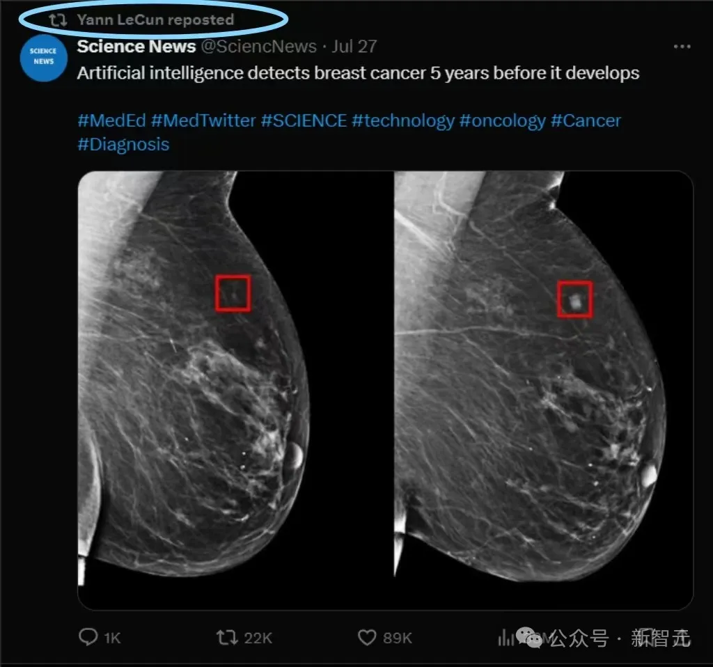 AI模型提早5年预警乳腺癌，MIT研究登Science获LeCun转发