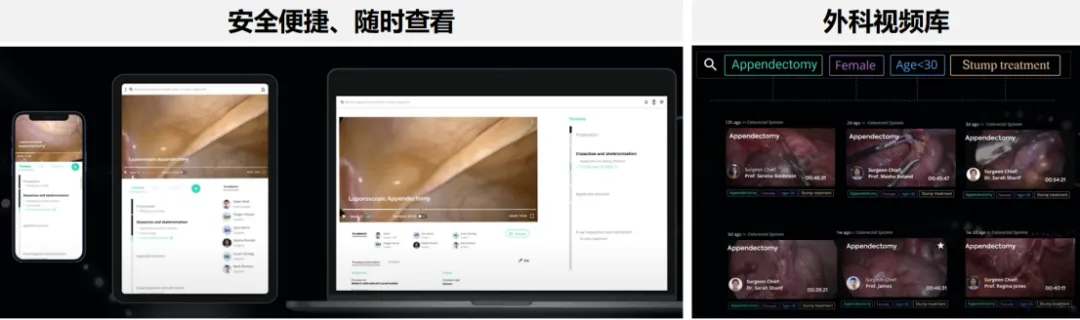 AI技术在微创外科中的应用和思考