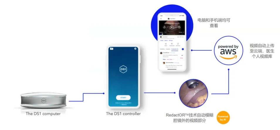 AI技术在微创外科中的应用和思考