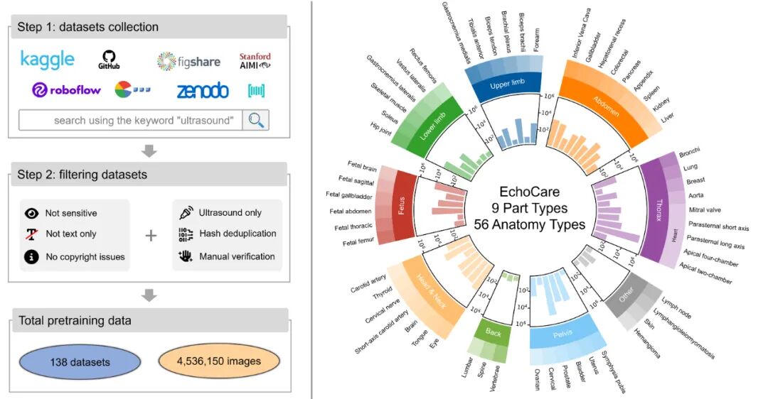 CAIR开源发布超声基座大模型EchoCare“聆音”，10余项医学任务性能登顶