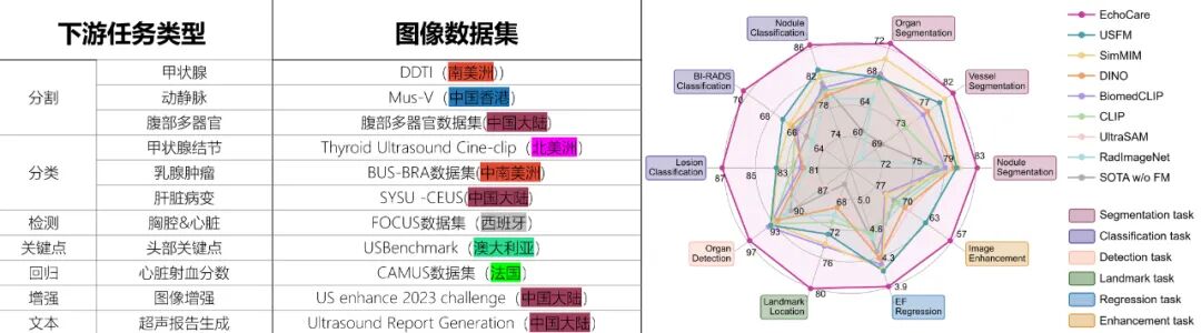 CAIR开源发布超声基座大模型EchoCare“聆音”，10余项医学任务性能登顶