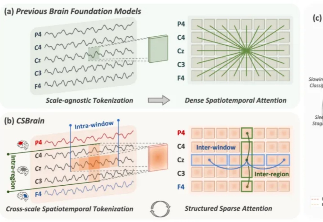 通用脑机接口时代要来了？跨尺度脑基础模型CSBrain真正读懂脑信号
