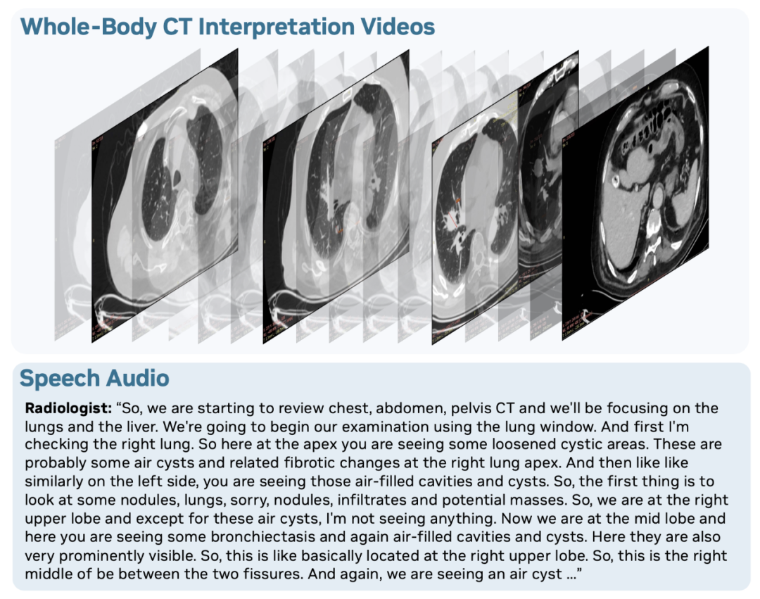 开源即爆火!英伟达重磅推出OmniVinci全模态大模型