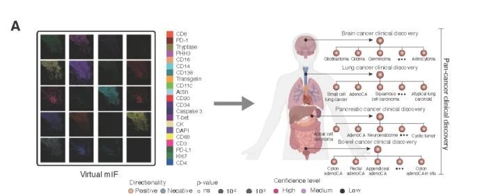 Cell重磅！微软开源首个AI肿瘤免疫模型，仅需几美元成本，一键看穿癌症底细！