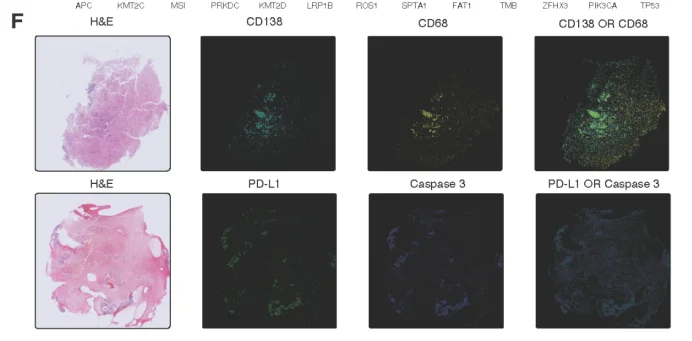 Cell重磅！微软开源首个AI肿瘤免疫模型，仅需几美元成本，一键看穿癌症底细！