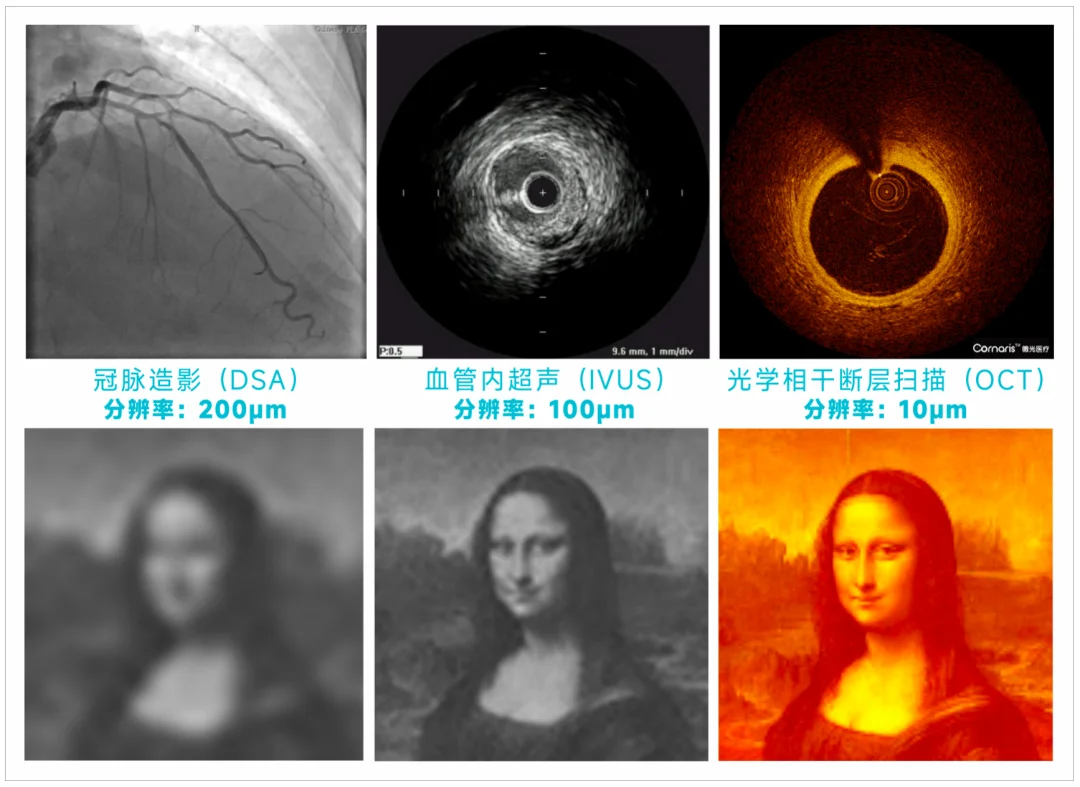 临床PK完胜ChatGPT-5!国内团队造出首个OCT影像AI系统