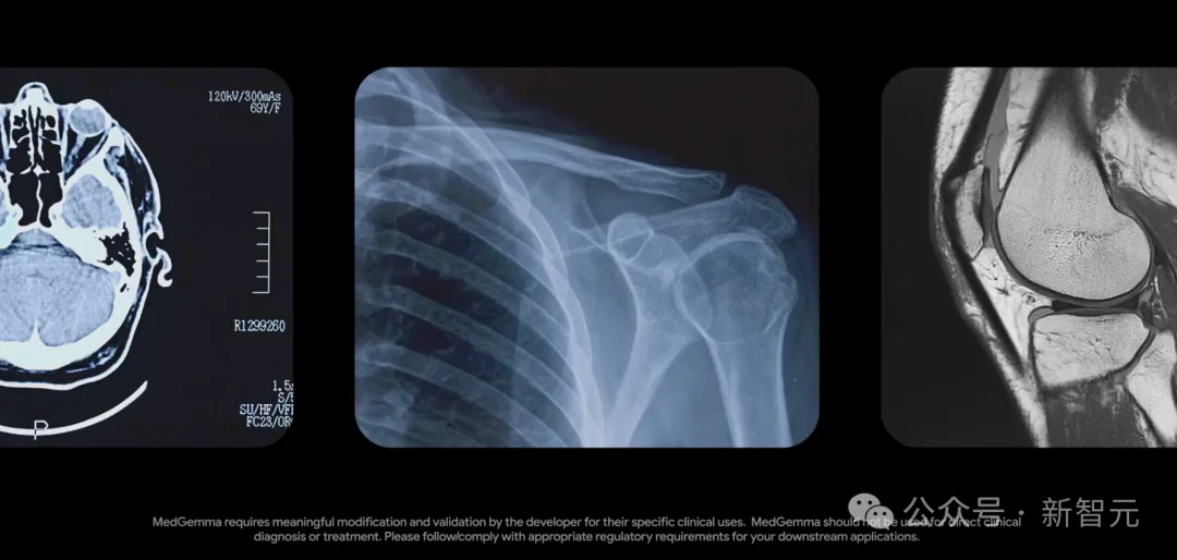 超前布局协和10年,这家国产AI「三冠王」终于藏不住了