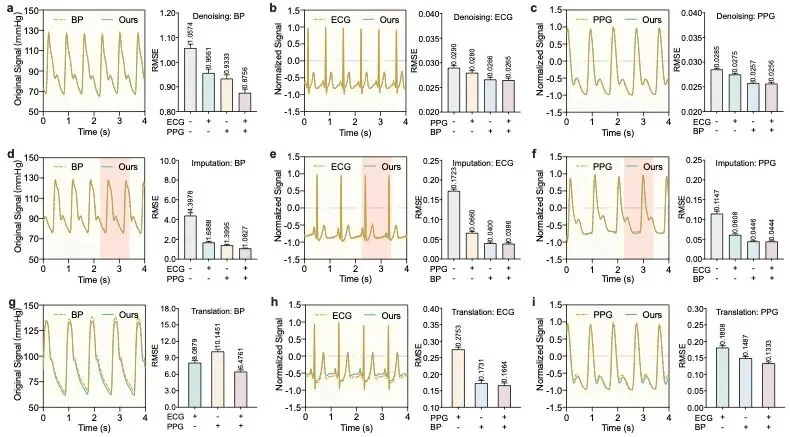 清华朱军团队Nature Machine Intelligence：多模态扩散模型实现心血管信号实时全面监测