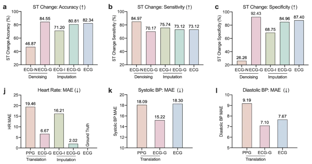 清华朱军团队Nature Machine Intelligence：多模态扩散模型实现心血管信号实时全面监测