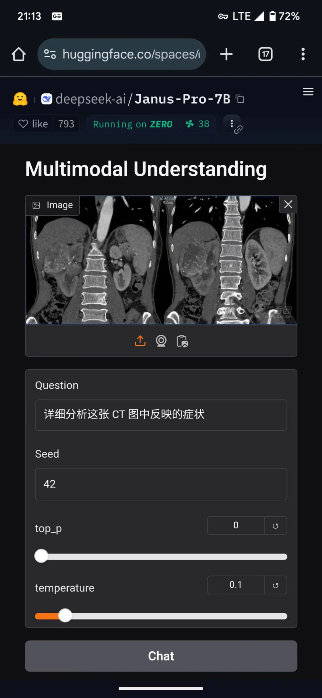 Deepseek多模态大模型Janus-Pro-7B在医疗领域的简单应用可行性测试