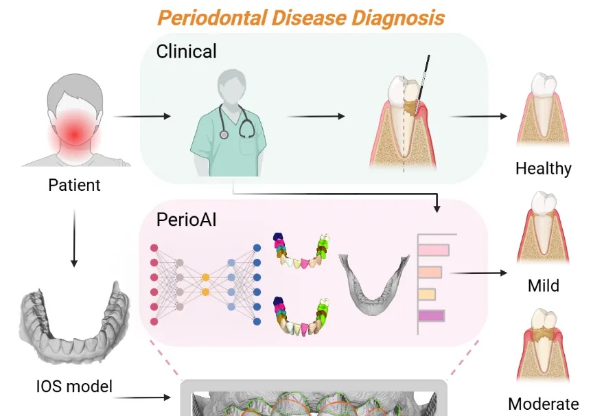 上科大沈定刚团队联合上海交大口腔医学院开发人工智能系统PerioAI助力牙周病精准诊断 | Cell Press对话科学家