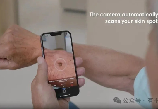 革新皮肤检测：SkinVision用AI守护皮肤健康