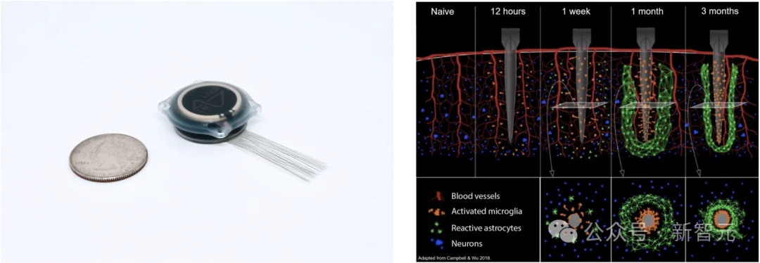 马斯克「脑机第一人」首爆！不开颅在线升级，永生代码已写入