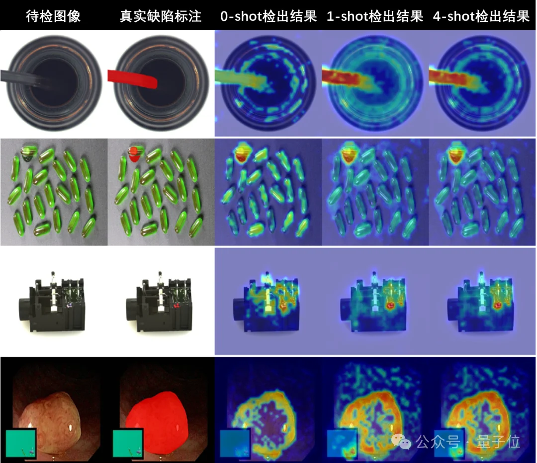零样本&少样本横扫12个工业医疗数据集：西门子×腾讯优图新研究精准定位缺陷，检测精度新SOTA丨AAAI 2026