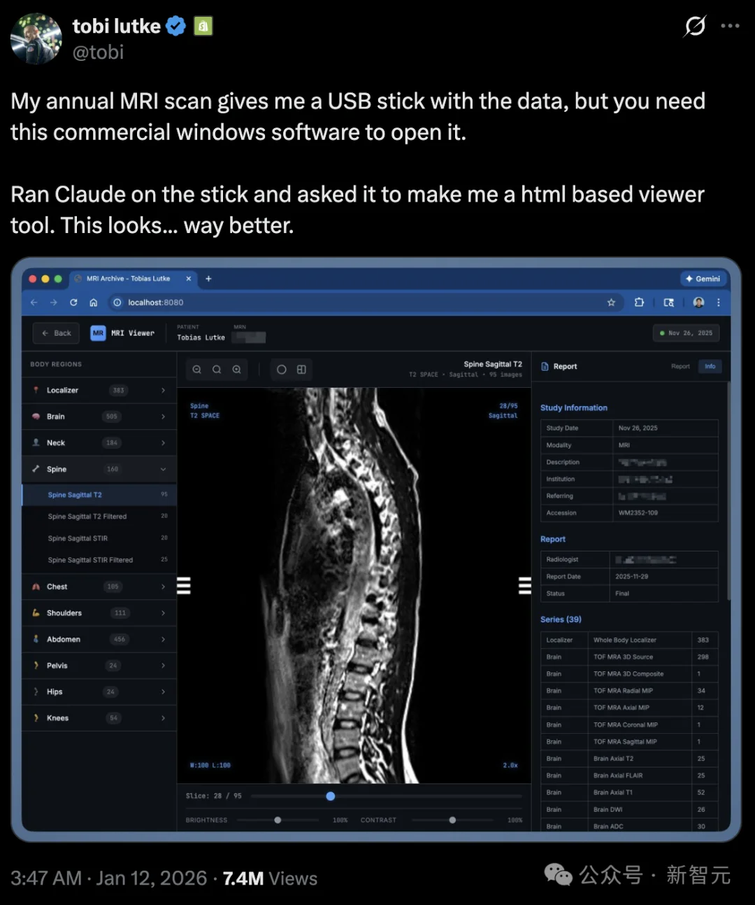刚刚，Claude实现「永久记忆」！官方还没上线，大神已玩疯