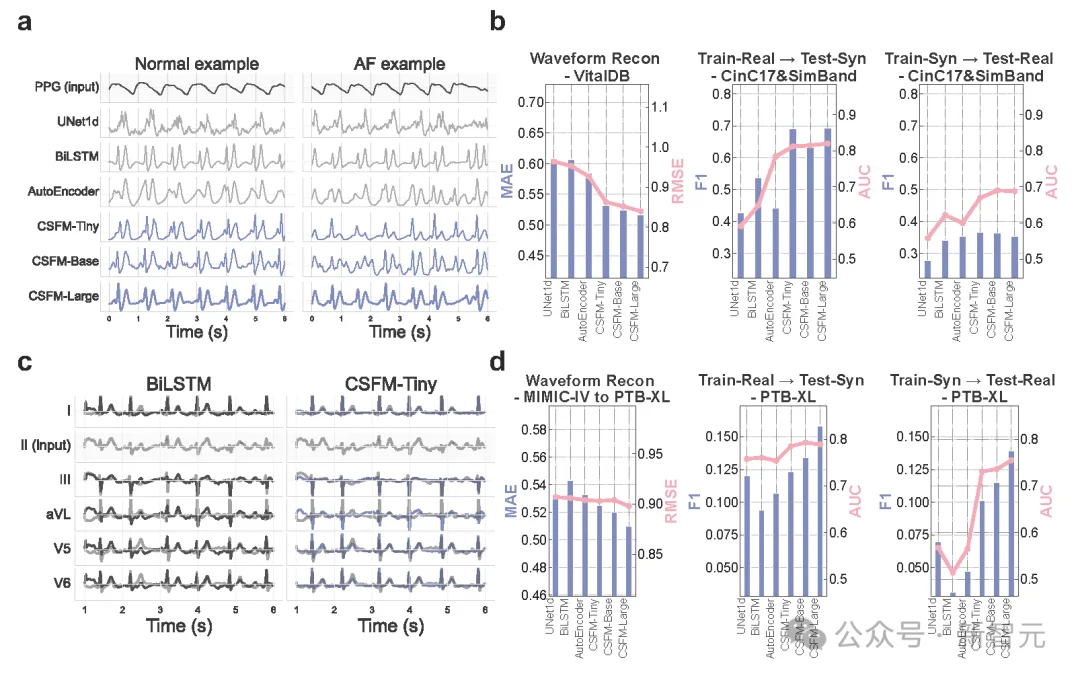 Nature子刊封面：牛津提出首个百万级多模态心脏基础模型CSFM