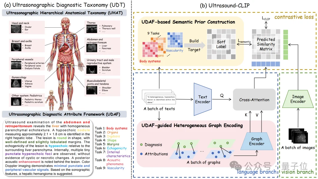 36.4万超声图文对！中国团队构建首个大规模超声专属数据集，让AI真正读懂临床诊断语义丨CVPR'26