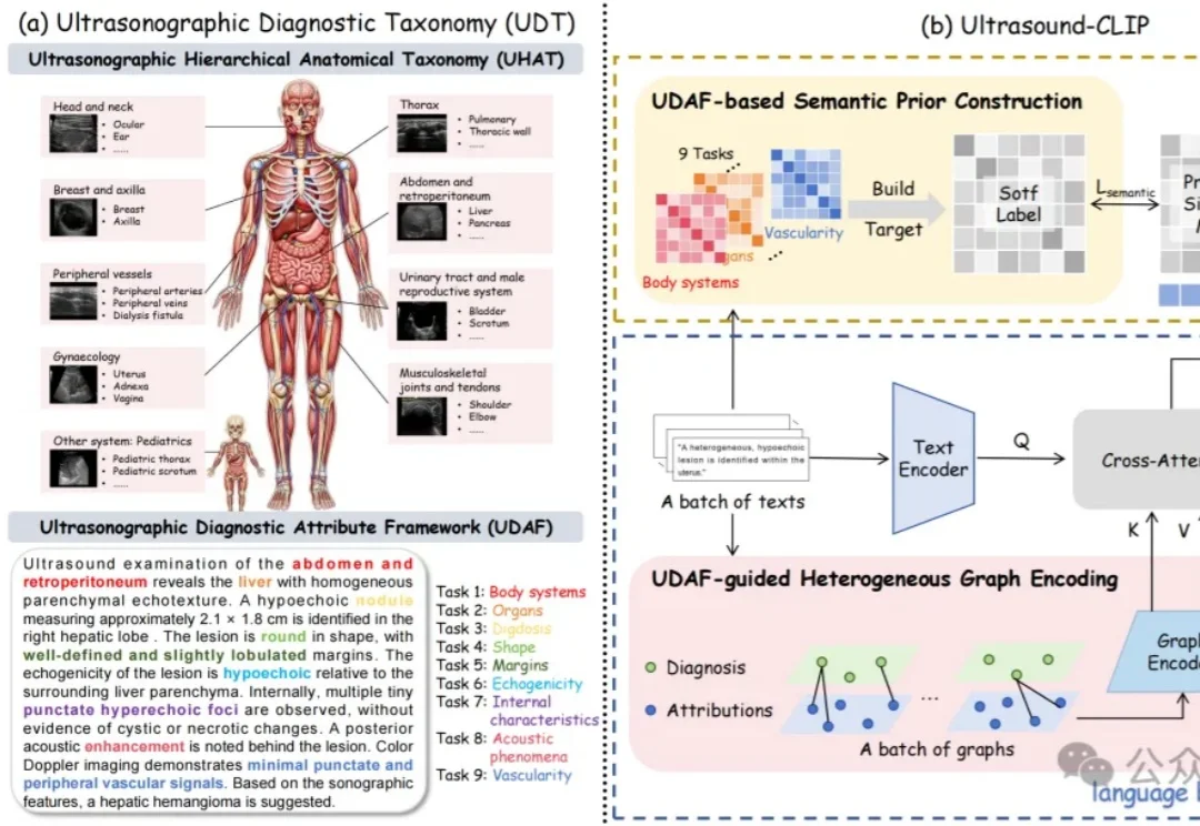 36.4万超声图文对！中国团队构建首个大规模超声专属数据集，让AI真正读懂临床诊断语义丨CVPR'26