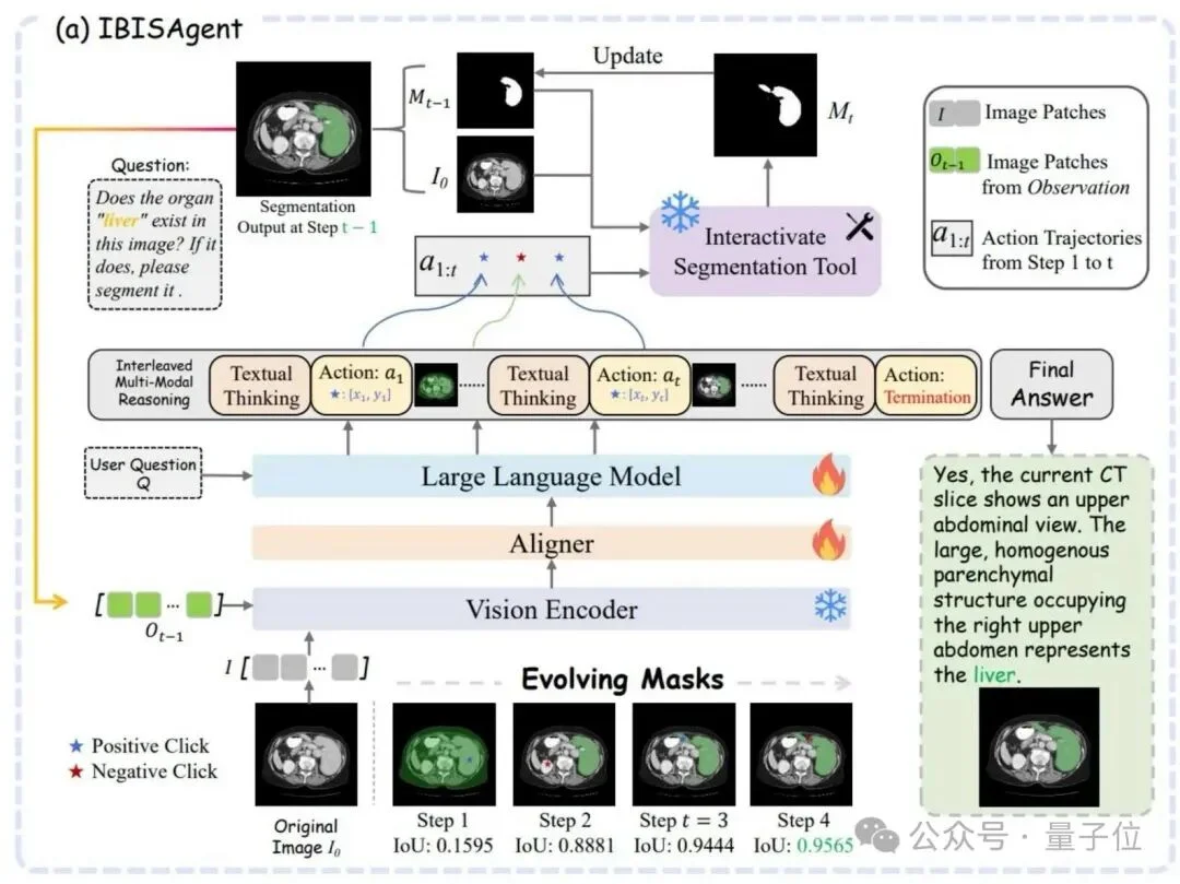 国产多模态Agent拿下医学分割SOTA！不用改模型、不加token | 浙大&上海AI Lab