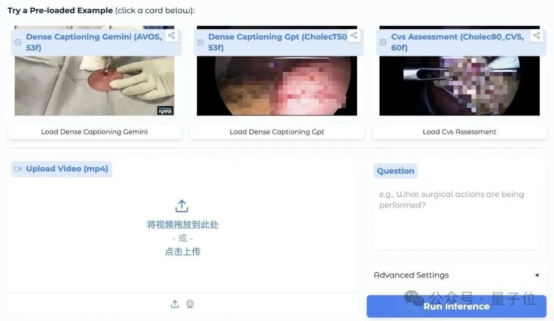 全球首个医疗视频理解大模型开源！6k+组精标测试集与英雄榜同步上线，开发者速来！