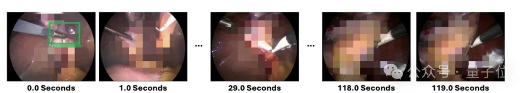 全球首个医疗视频理解大模型开源！6k+组精标测试集与英雄榜同步上线，开发者速来！