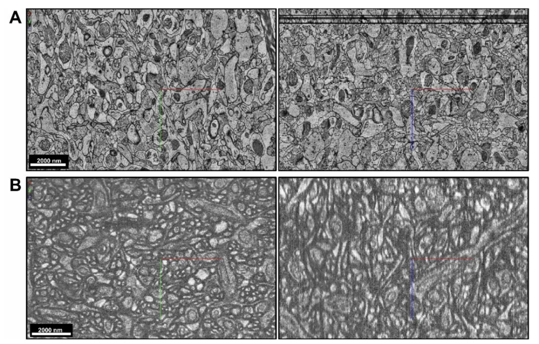 打不过AI就加入？他辍学MIT，要把人类意识装进芯片，创造「数字生命」