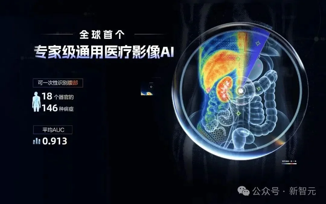 Hinton错了!中国AI登顶Science,全球首个专家级通用影像AI来了